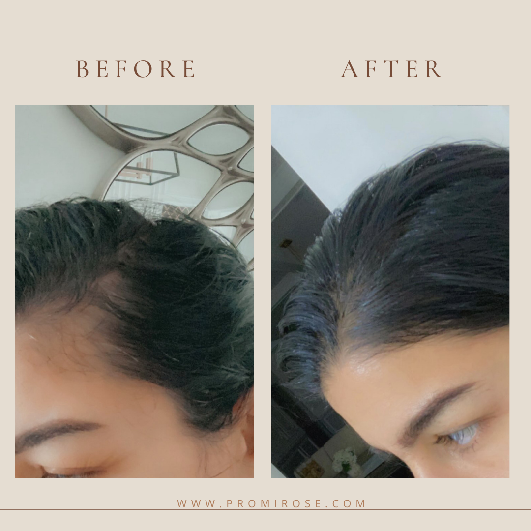 Promirose Shampoo & Conditioner + travel bag