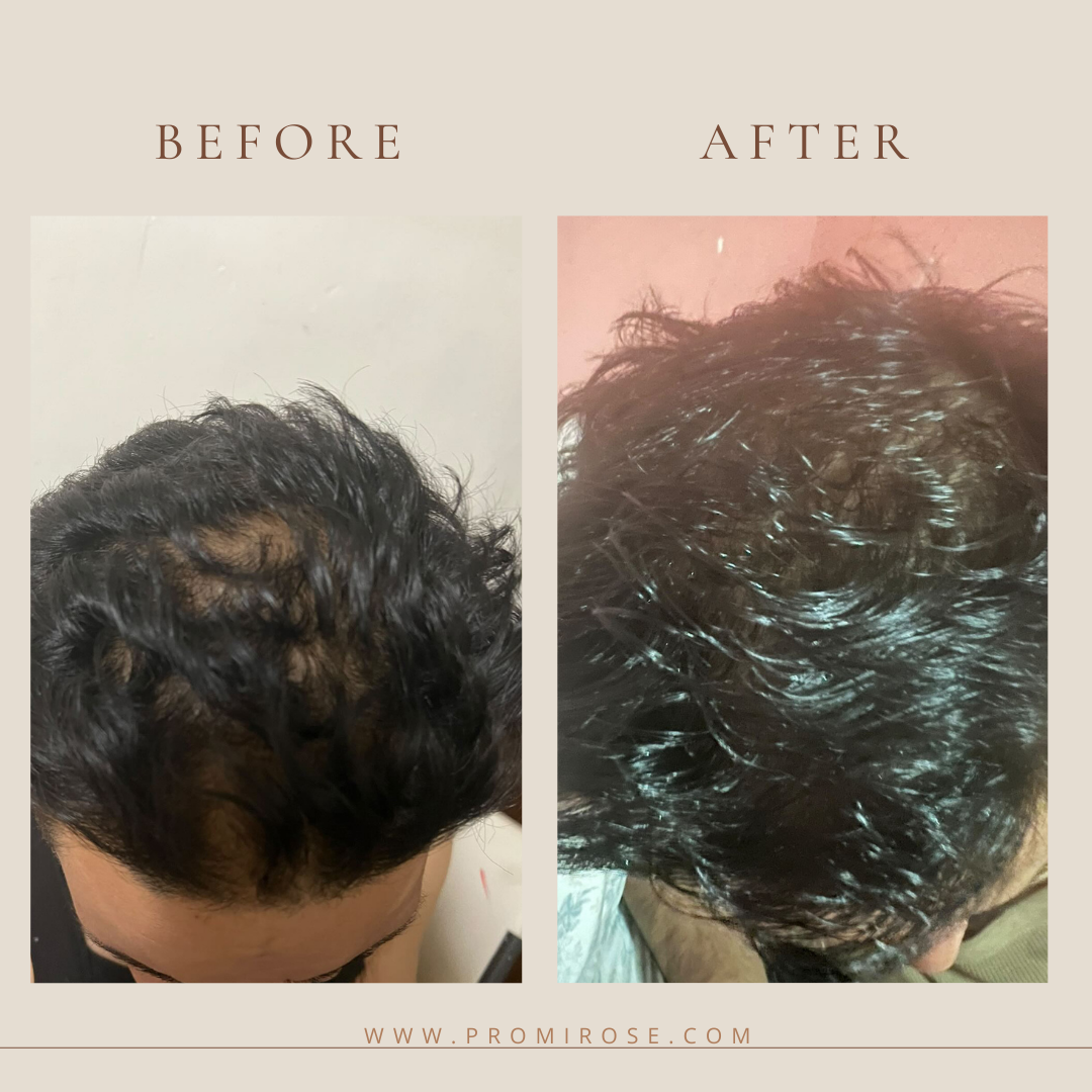 2 Natural hair growth oils PROMIROSE