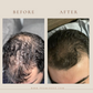 6 promirose hair growth oil