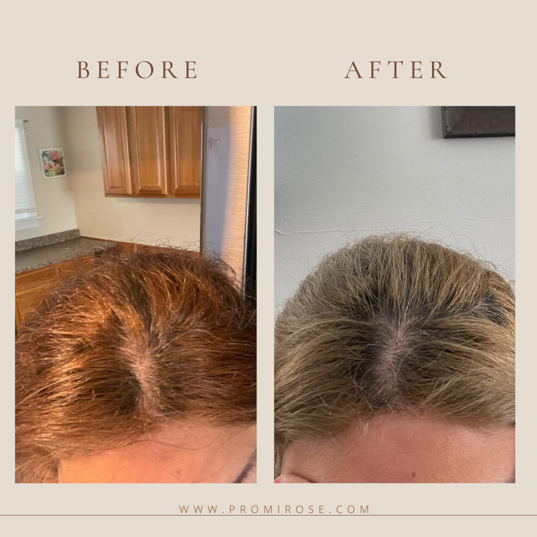3 promirose hair growth oil